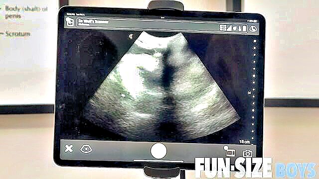 big dick, bareback, big tall - anal ultrasound doctor love trans sex